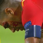 Sangra el «Tigre» Falcao