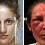 Mira como quedó el rostro de una peleadora tras su combate