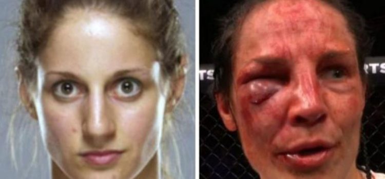 Mira como quedó la cara de una peleadora tras su combate