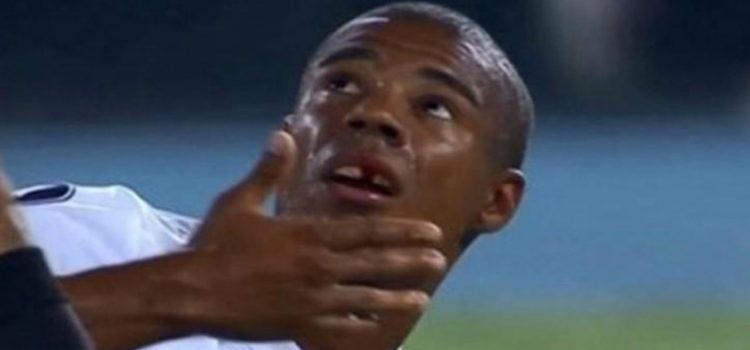 ¡Jugador de River Plate perdió un diente!