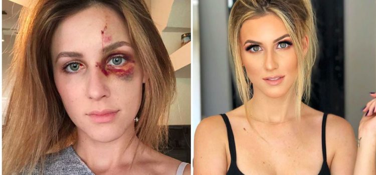 Piloto de Motocross golpea a su novia por subir foto a Instagram