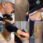 Futbolista turco salta al campo con una cuchilla de afeitar y agrede a varios rivales