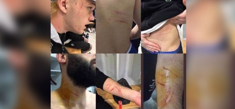Futbolista turco salta al campo con una cuchilla de afeitar y agrede a varios rivales