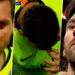 Messi recibió un codazo en la cara y terminó sangrando
