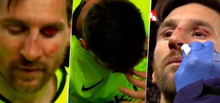 Messi recibió un codazo en la cara y terminó sangrando