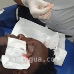 Javier Portillo propina codazo a Wilmer Crisanto y le deja cuatro puntadas en el rostro