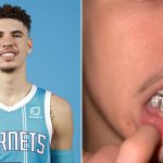 Una dentadura de oro y diamantes: el extravagante capricho del nuevo niño rico de la NBA