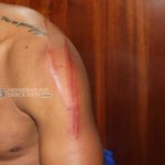 Iván «Chino» López muestra las heridas tras la falta de Elvin Casildo
