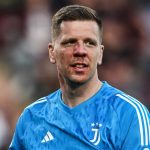 Szczesny, operado de la nariz tras recibir un golpe ante el Torino
